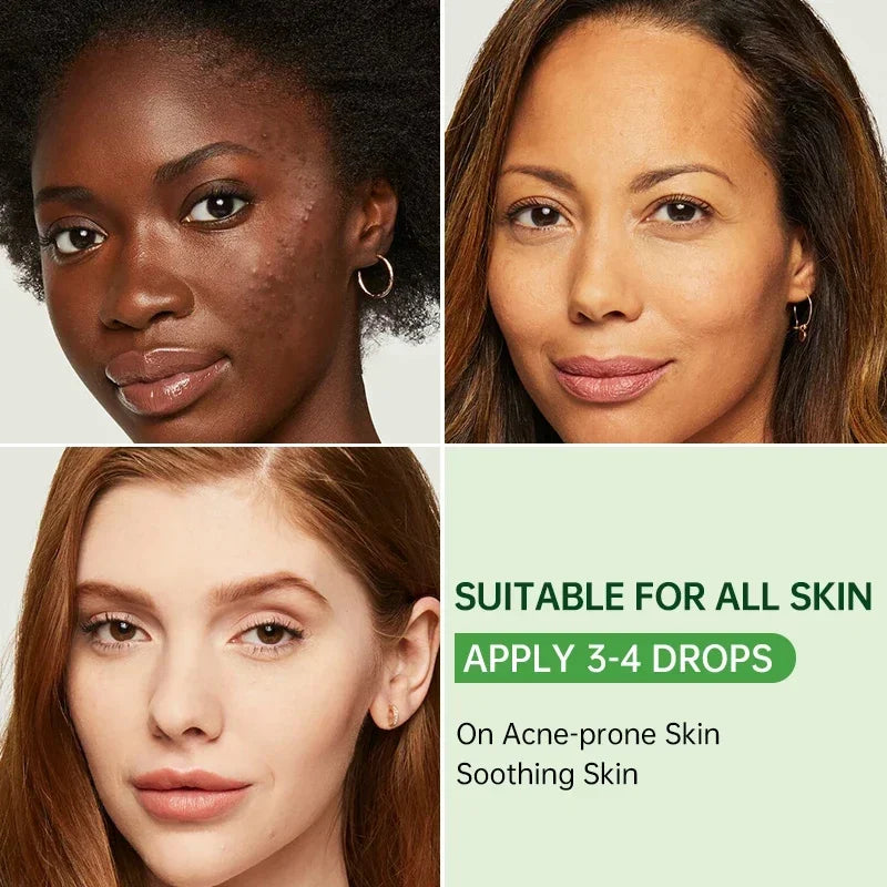 Tea Tree Acne Removal Facial Serum Anti Acne Pimples Remover Black head Pores Shrinking Essential Oil Control Smooth Skin Care