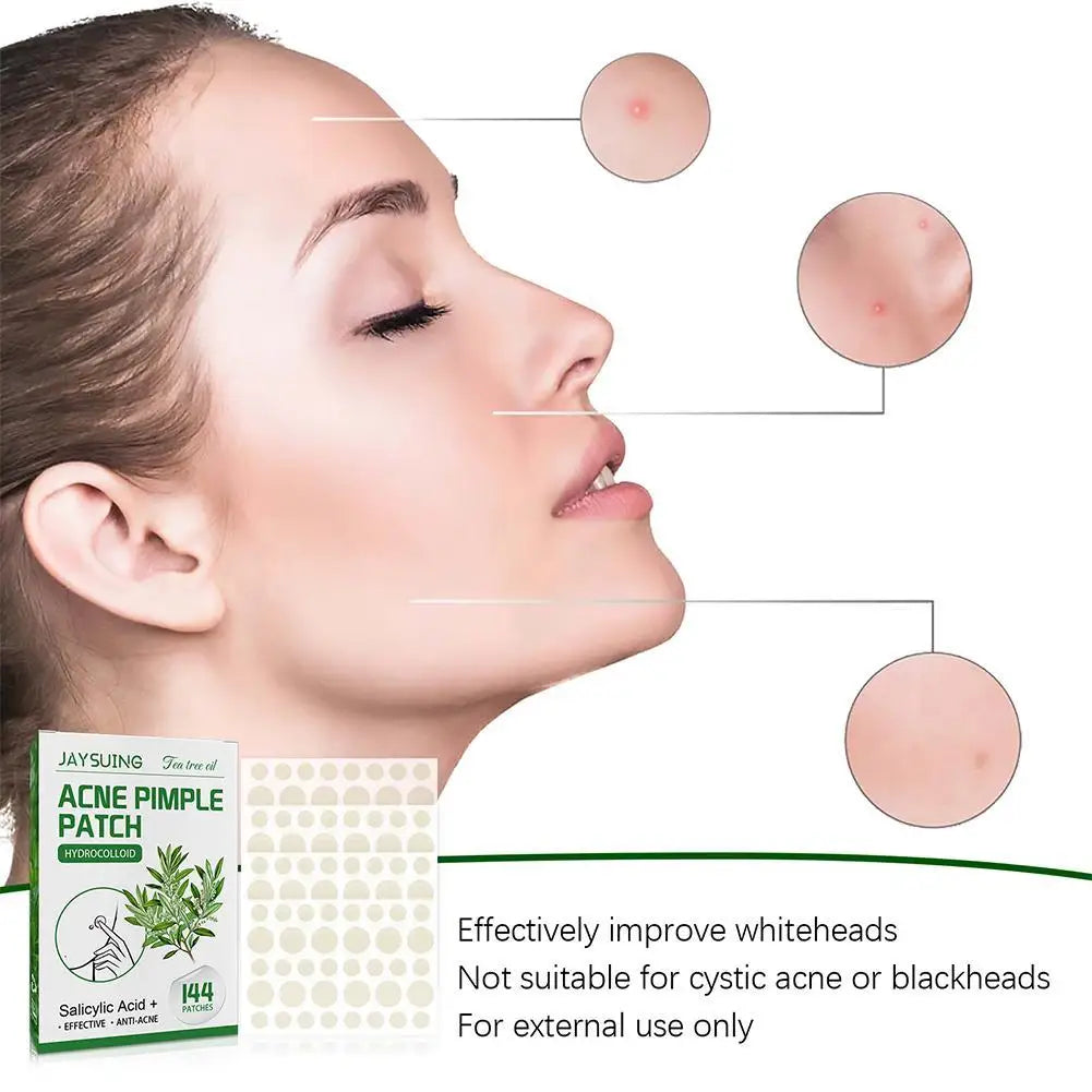 Tea Tree Oil Acne Pimple Patches Translucent Matte Hydrocolloid Salicylic Acid Tea Tree Oil For Inflamed Acne Improve Whiteheads
