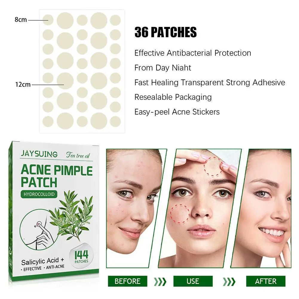Tea Tree Oil Acne Pimple Patches Translucent Matte Hydrocolloid Salicylic Acid Tea Tree Oil For Inflamed Acne Improve Whiteheads