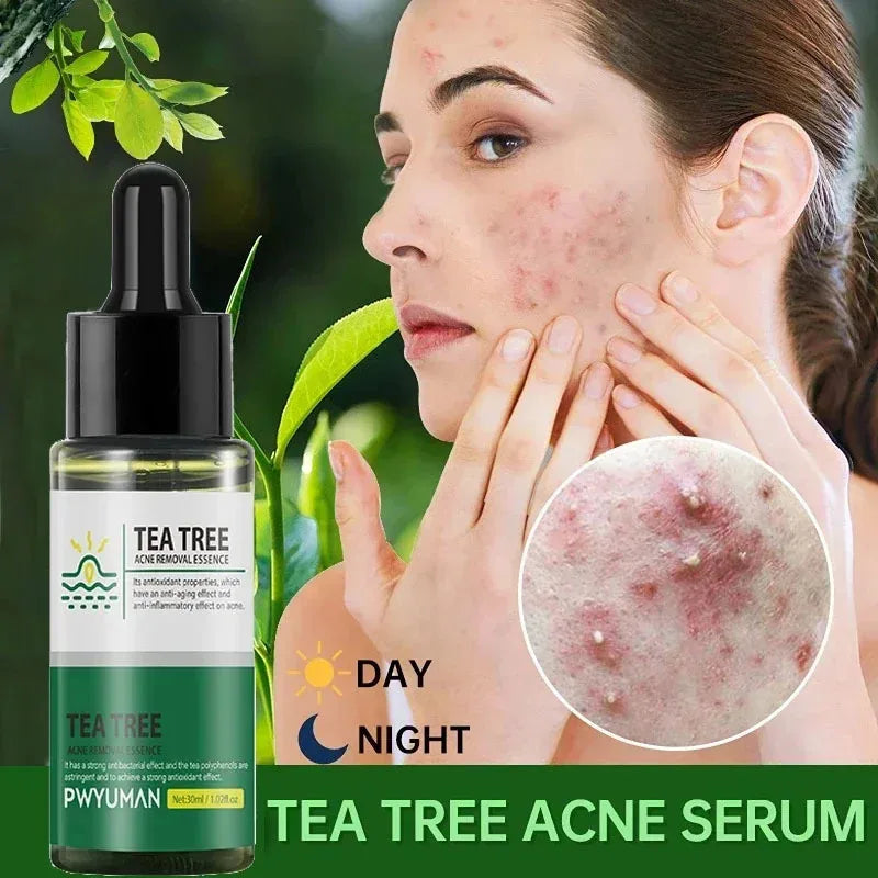 Tea Tree Acne Removal Facial Serum Anti Acne Pimples Remover Black head Pores Shrinking Essential Oil Control Smooth Skin Care