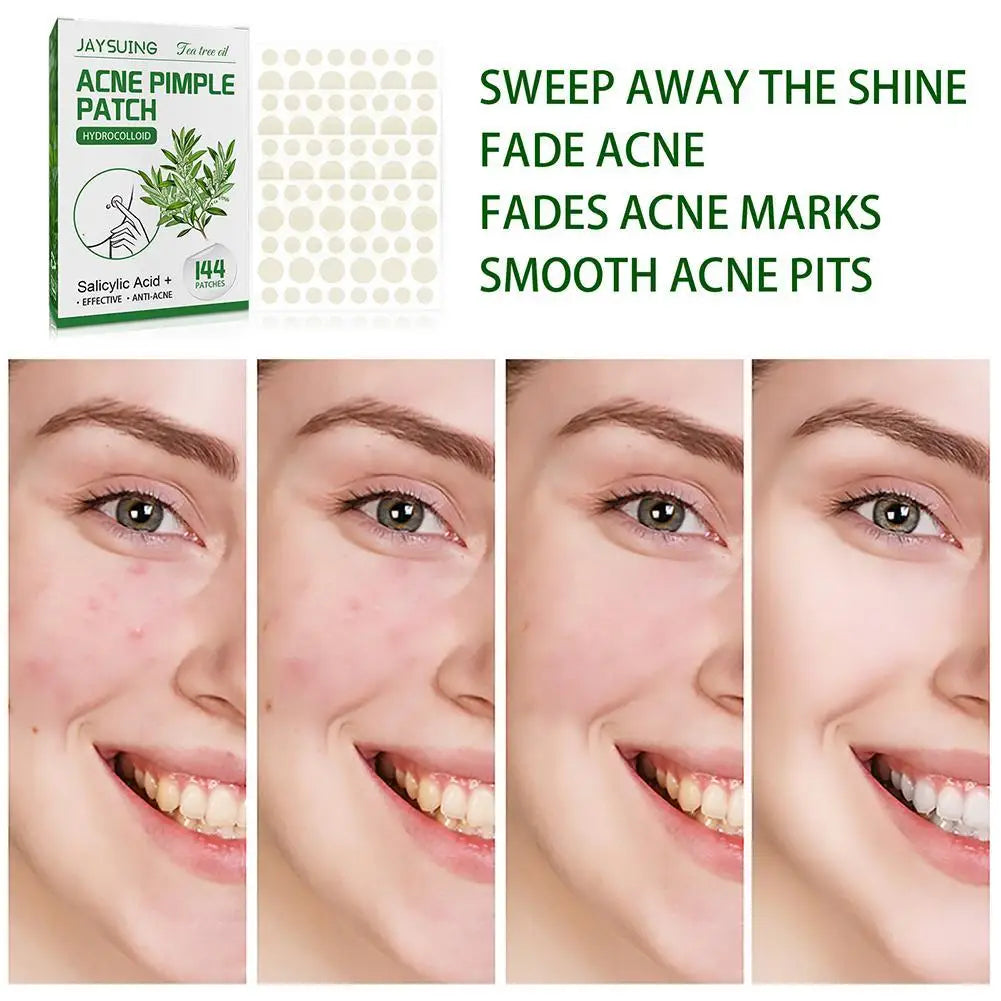 Tea Tree Oil Acne Pimple Patches Translucent Matte Hydrocolloid Salicylic Acid Tea Tree Oil For Inflamed Acne Improve Whiteheads