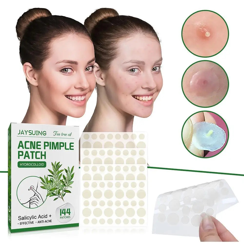 Tea Tree Oil Acne Pimple Patches Translucent Matte Hydrocolloid Salicylic Acid Tea Tree Oil For Inflamed Acne Improve Whiteheads