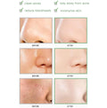 Deep Cleaning Face Mask for Clear, Radiant Skin - Aura Beauty - aura beauty cosmetics