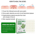 Tea Tree Oil Acne Patches: Hydrocolloid Pimple Treatment (144 Pcs) - aura beauty cosmetics