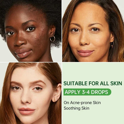 Tea Tree Acne Removal Facial Serum Anti Acne Pimples Remover Black head Pores Shrinking Essential Oil Control Smooth Skin Care