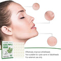 Tea Tree Oil Acne Patches: Hydrocolloid Pimple Treatment (144 Pcs) - aura beauty cosmetics