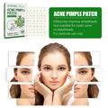 Tea Tree Oil Acne Patches: Hydrocolloid Pimple Treatment (144 Pcs) - aura beauty cosmetics