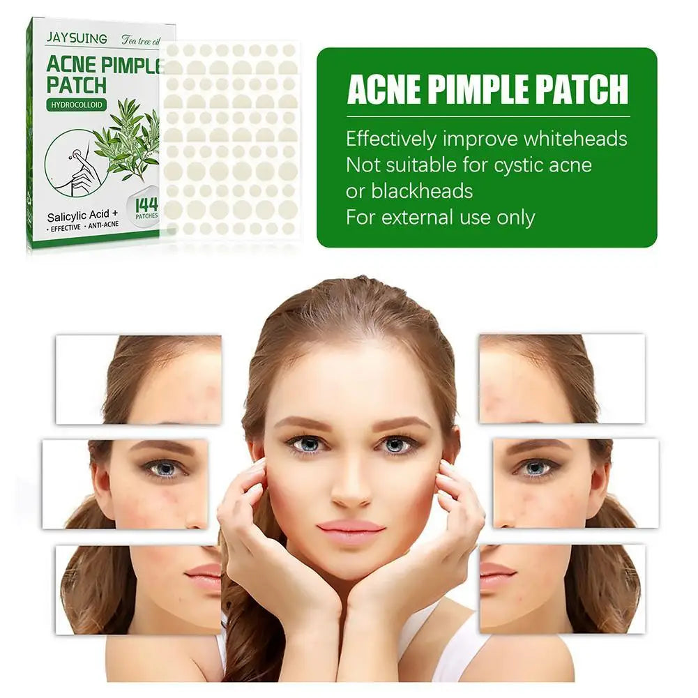 Tea Tree Oil Acne Pimple Patches Translucent Matte Hydrocolloid Salicylic Acid Tea Tree Oil For Inflamed Acne Improve Whiteheads