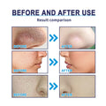 EELHOE Bamboo Charcoal Mask: Deep Cleansing Blackhead Remover for Face - aura beauty cosmetics