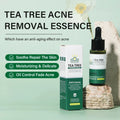 Tea Tree Acne Removal Serum: Anti-Acne & Pore Minimizer - Aura Beauty - aura beauty cosmetics
