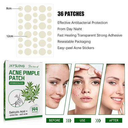 Tea Tree Oil Acne Pimple Patches Translucent Matte Hydrocolloid Salicylic Acid Tea Tree Oil For Inflamed Acne Improve Whiteheads