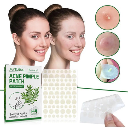 Tea Tree Oil Acne Pimple Patches Translucent Matte Hydrocolloid Salicylic Acid Tea Tree Oil For Inflamed Acne Improve Whiteheads