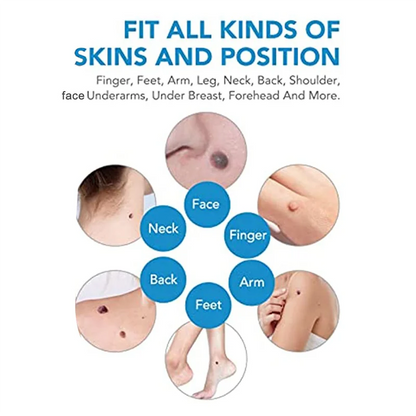 2 In1 Painless Auto Skin Tag Mole Wart Removal Kit Skin Care Body Wart Dot Treatments Remover Cleaning Tools