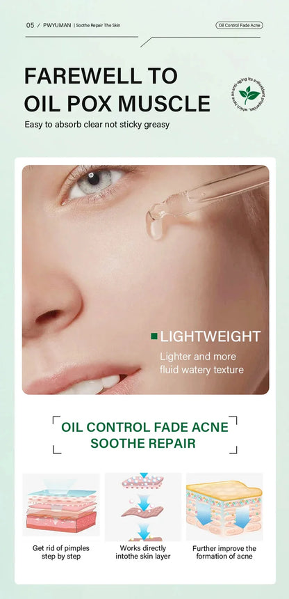 Tea Tree Acne Removal Facial Serum Anti Acne Pimples Remover Black head Pores Shrinking Essential Oil Control Smooth Skin Care