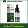 Tea Tree Acne Removal Serum: Anti-Acne & Pore Minimizer - Aura Beauty - aura beauty cosmetics