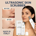 Aura Beauty Ultrasonic Skin Scrubber | Deep Cleanse & Exfoliate - aura beauty cosmetics