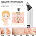 Aura Beauty Blackhead Remover Tool - Deep Pore Cleansing & Extraction - aura beauty cosmetics