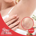 Razor Bumps & Ingrown Hair Solution - 8oz Skin Care Miracle - aura beauty cosmetics